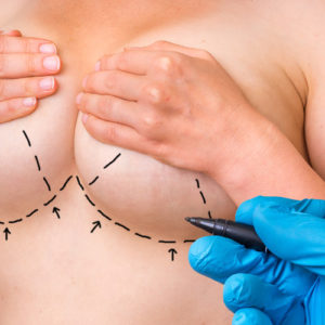 Cauzele micșorării sânilor (atrofia sânilor)